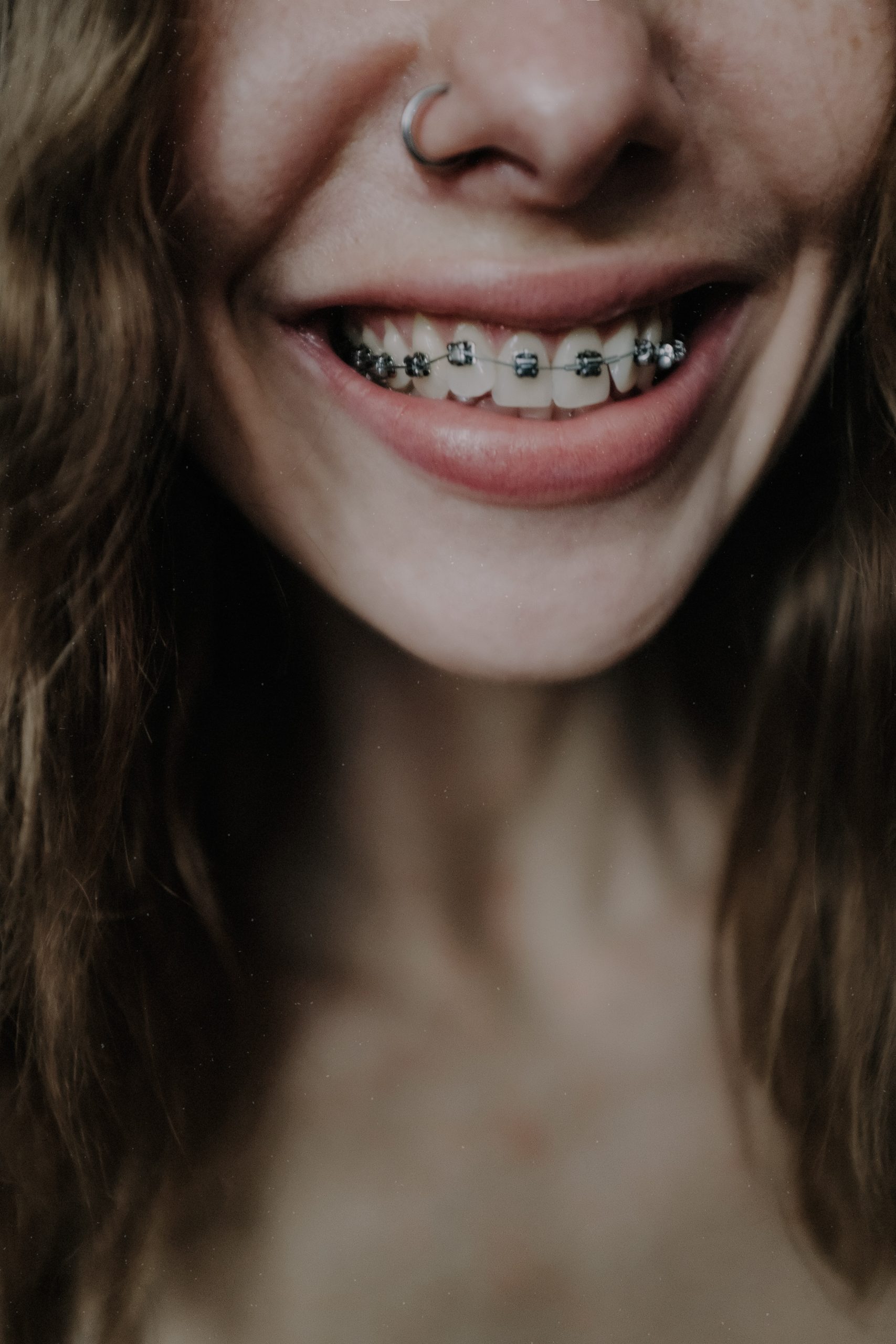Braces and Oral Health