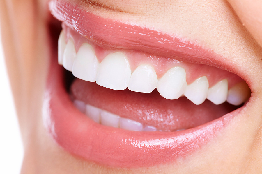 Why You Need a Mouth Guard While Wearing Braces: Protecting Your Smile